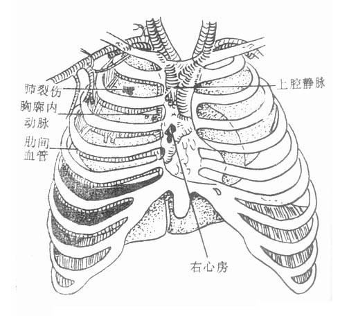64401.jpg (51438 字节)