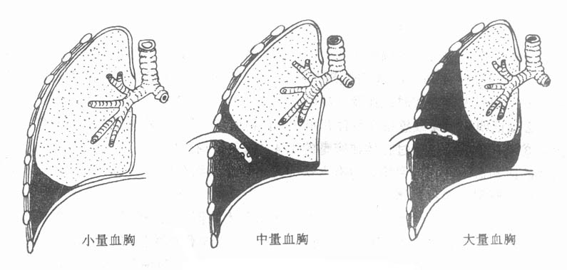 64501.jpg (45075 字节)