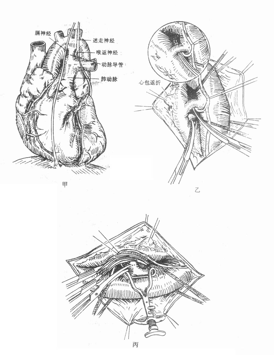 69301.jpg (156108 字节)