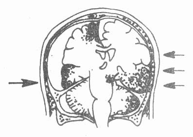 58501.jpg (20980 字节)