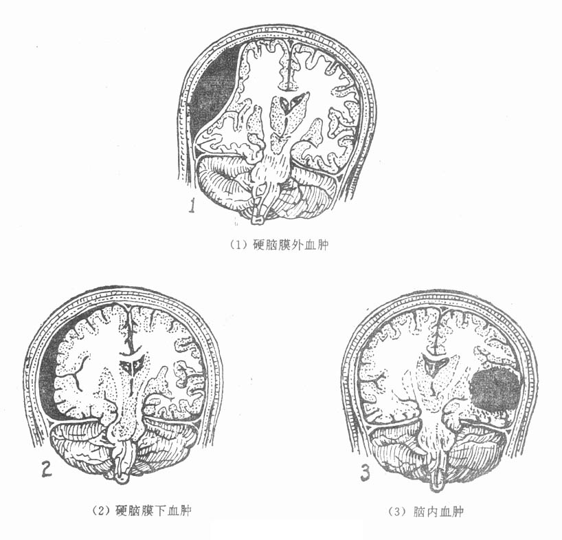 58901.jpg (94237 字节)
