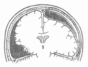 59003.jpg (20293 字节)
