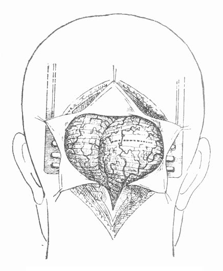 60701.jpg (36430 字节)