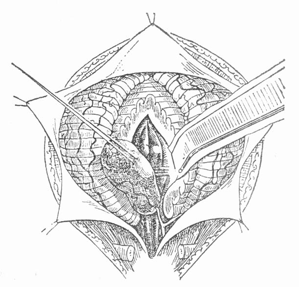 60902.jpg (75184 字节)