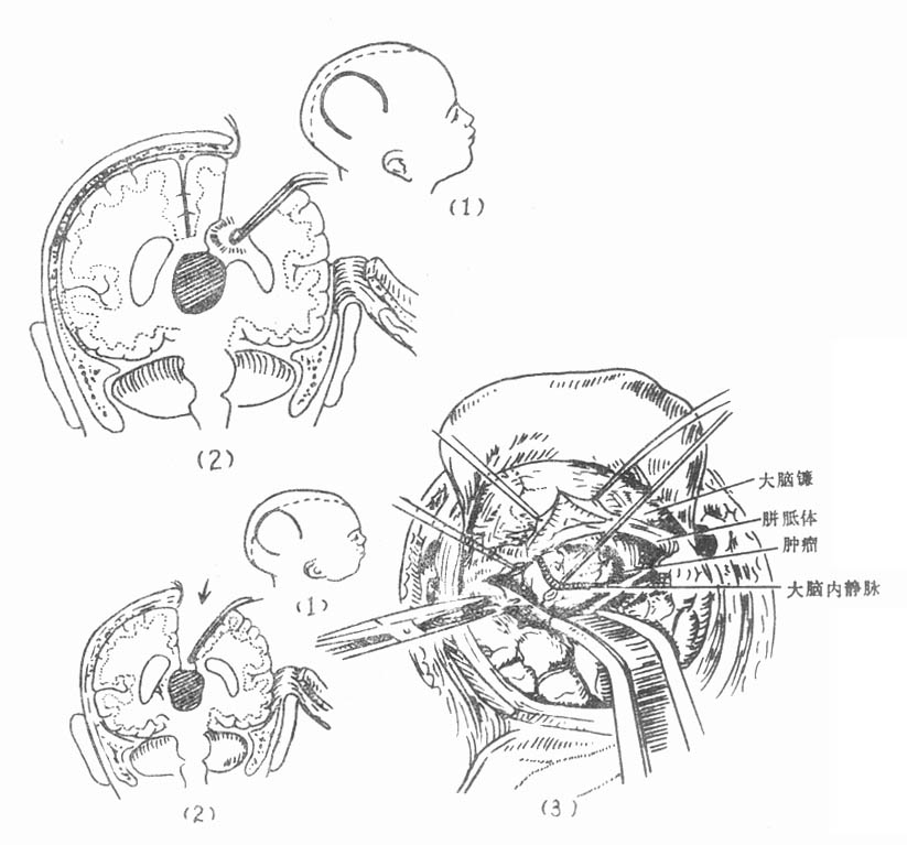 61001.jpg (86904 字节)