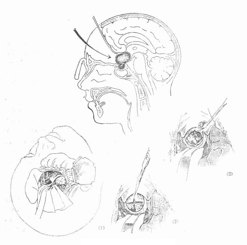 61301.jpg (76522 字节)