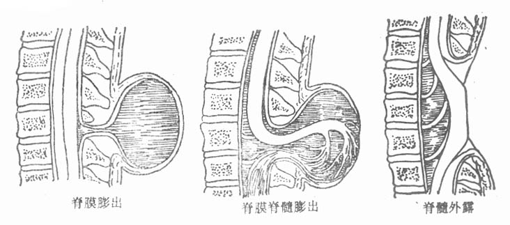 62801.jpg (48990 字节)
