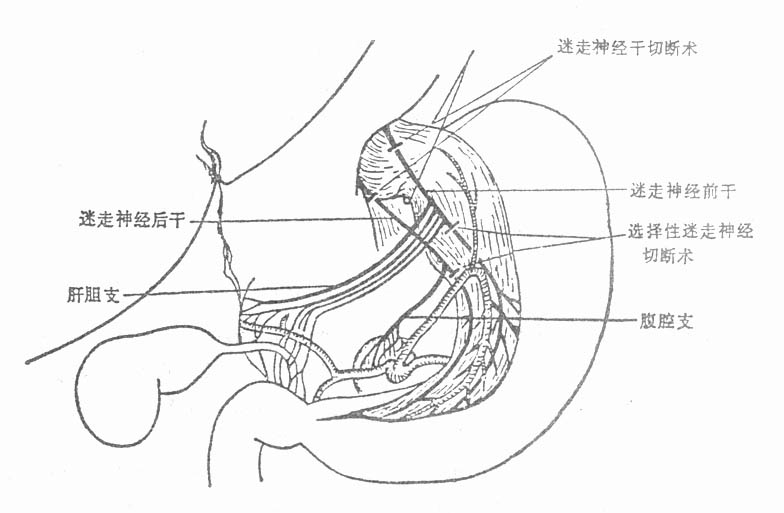 24701.jpg (46081 字节)