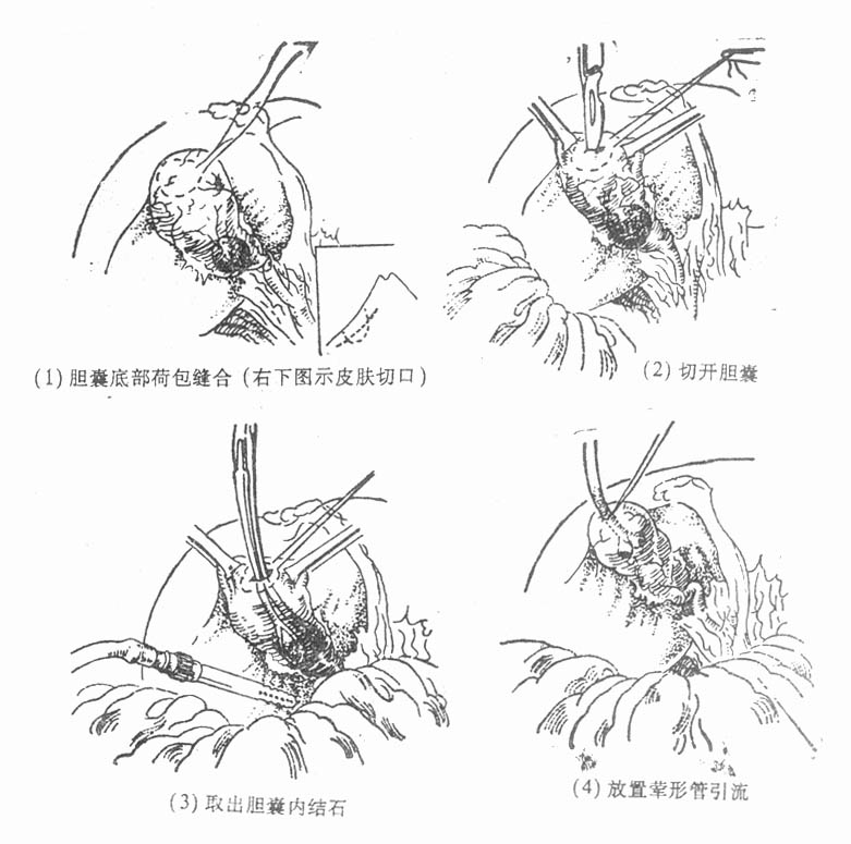 29901.jpg (87259 字节)