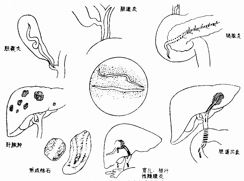30201.jpg (92251 字节)