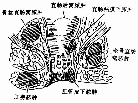 35401.jpg (63327 字节)