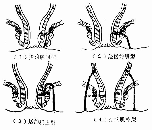 35601.jpg (64131 字节)